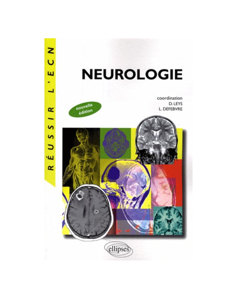 Neurologie. Nouvelle édition