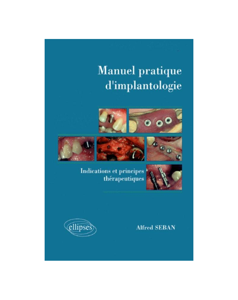 Manuel pratique d'implantologie - Indications et principes thérapeutiques